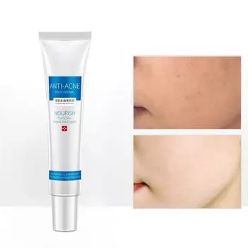 Крем для лечения прыщей, увлажняющее масло для контроля, сужение пор, удаление следов, средство для удаления прыщей 5G
