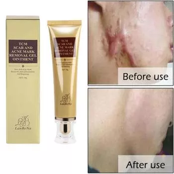 Крем для лечения ран и удаления следов, мазь для кожи