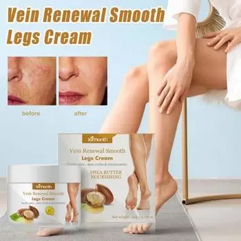 Крем для лечения варикозного расширения вен, укрепляющий здоровье капилляров, быстрое впитывание, снятие отечности, боли, естественное лечение сосудистых звездочек при варикозном васкулите 60g