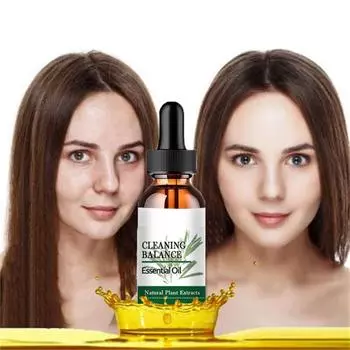 Крем для лица, для ухода за кожей лица и тела, содержит ниацинамид и гиалуроновую кислоту, уход за кожей тела и интимной зоны5G/15G/30G/50G 5ml