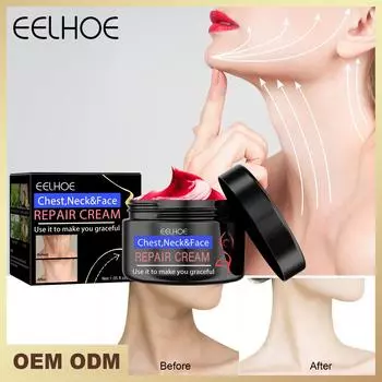 Крем для лица Eelhoe, уход за кожей против морщин, укрепляющая косметика с гиалуроновой кислотой, увлажняющие, отбеливающие косметические продукты 30g