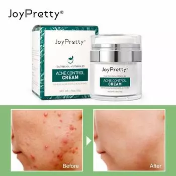 Крем для лица от прыщей с салициловой кислотой, лечение шрамов от прыщей, ниацинамид, отбеливающее средство для удаления черных точек, кремы для лица, средство для ухода за кожей зелёный