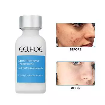 Крем для лица, универсальный тип кожи, уменьшает темные пятна, мягкий креативный лосьон для восстановления тусклой кожи для женщин 30ML