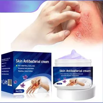 Крем для местного ухода за кожей от укусов комаров Violet Skin 30 г One Size белый