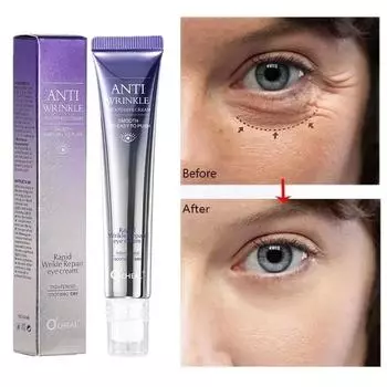 Крем для мгновенного удаления мешков под глазами с коллагеном, против морщин, разглаживание мелких морщин, укрепление кожи, против темных кругов, отечности, осветление кожи, уход за кожей вокруг глаз