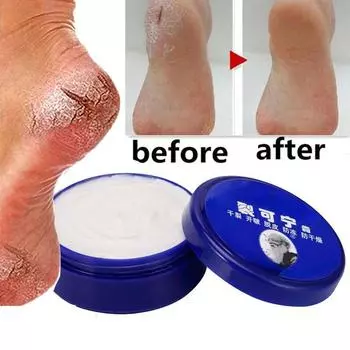 Крем для ног против трещин, сухость, ремонт трещин на пятках, увлажняющий крем для рук, уход за ногами 33g синий