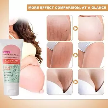 Крем для профилактики растяжек, масло для рубцов и растяжек без парабенов, лечение рубцов с помощью коллагена, крем для устранения растяжек