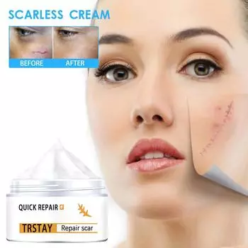 Крем для ран на коже, крем для сжигания и выцветания, хирургический ремонт, уход за шрамами, отбеливающий крем для кожи 5g