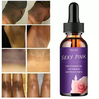 Крем для сияния кожи на коленях и локтях от черных точек устраняет тусклость, осветляет тон кожи, увлажняет и питает 5ml