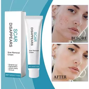 Крем для удаления акне, растяжек, меланина, осаждения старых One Size