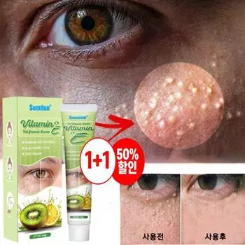 Крем для удаления милиумов, темных кругов, мешков под глазами, морщин под глазами, крем для кожи вокруг глаз для удаления жира 20 г