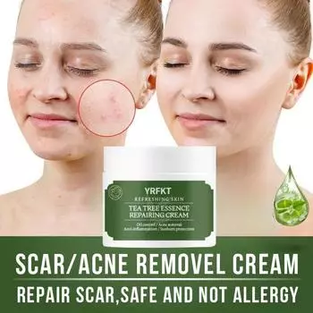 Крем для удаления прыщей, отбеливающий, исчезающих пятен, крем для удаления шрамов от прыщей, восстановление шрамов от прыщей, сужение пор, уход за кожей 5G