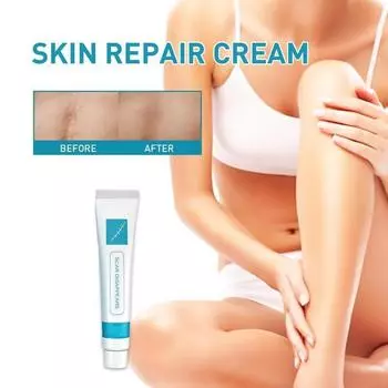 Крем для удаления шрамов от прыщей, растяжек, гель для лица, удаление акне, разглаживание, отбеливание, уход за кожей тела, корректор пигментации 5G