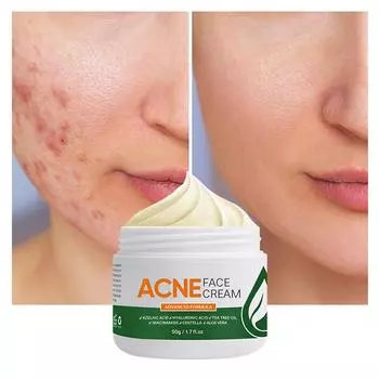 Крем для удаления угрей, закрытие следов от угрей, крем для удаления угрей, устранение черных точек и увлажнение лица One Size белый