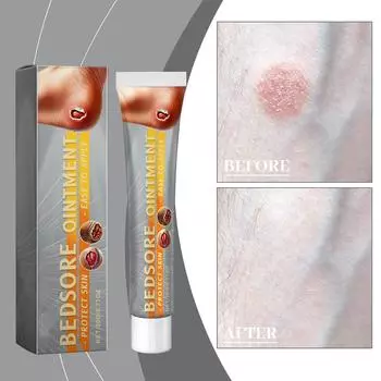 Крем для ухода за кожей, увлажняющий уход за кожей для ремиссии сухой и грубой кожи, нежный уходовый крем One Size