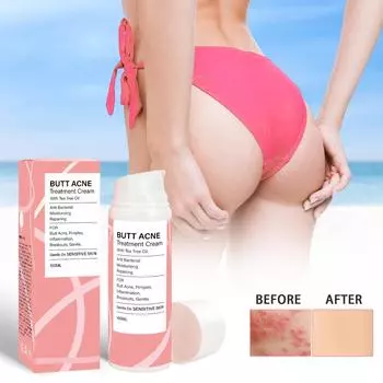 Крем для ухода за ягодицами от прыщей Эффективно устраняет фолликулит угревой сыпи, крем для ухода за ягодицами от прыщей Увлажняющий крем для ягодиц Уменьшает прыщи на теле One Size белый