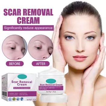 Крем для ухода за шрамами, Увлажняющий крем для ухода за кожей лица от шрамов, Увлажняющий крем для гладкой кожи One Size