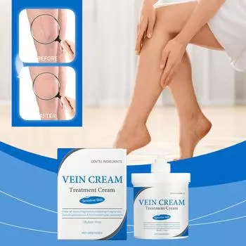 Крем для ухода за варикозным расширением вен массирует синие вены и красные кровеносные сосуды, уменьшая варикозное расширение вен и обеспечивая постоянное увлажнение для предотвращения сухости кожи. белый