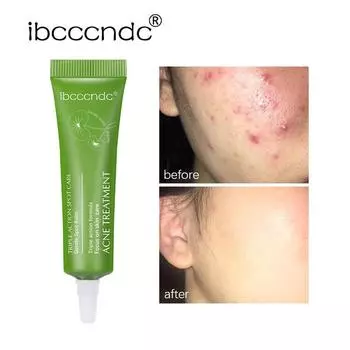 Крем Herbal Essence Acne Cream Эффективное удаление акне Пигментный крем для удаления рубцов и отложений