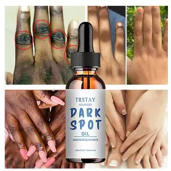 Крем от черных точек TRSTAY омолаживает, уменьшает морщины, улучшает поврежденную кожу, делает ее нежной, яркой и гладкой. 5ml