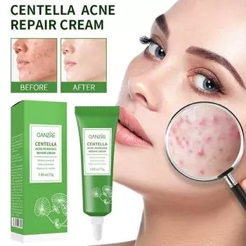 Крем от прыщей Centella Asiais 15g