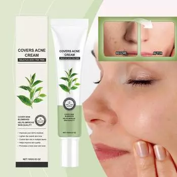 Крем от прыщей. Освежающий крем для устранения прыщей, контроля жирности кожи, восстанавливающий баланс увлажнения кожи, эффективно скрывающий недостатки кожи. белый