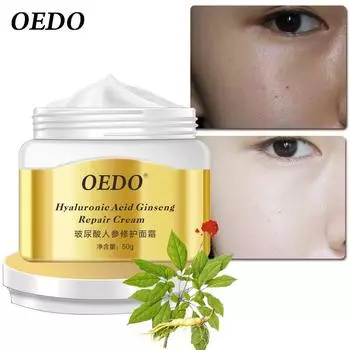 Крем от прыщей с женьшенем и гиалуроновой кислотой, крем для лица с принтом прыщей, средство для удаления прыщей, средство против прыщей, контроль жирности лица, уход за кожей