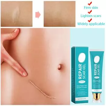 Крем от шрамов, крем для удаления шрамов для мужчин и женщин, разглаживание кожи, укрепление и исчезновение, глубокое разглаживание кожи, нежное внешнее воздействие всех видов One Size