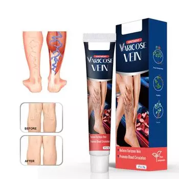 Крем от варикозного расширения вен, крем от варикозного расширения вен для ног 20 г белый