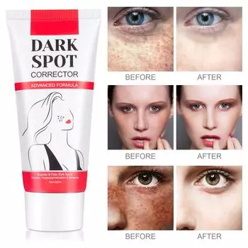 Крем против веснушек, осветляющий, маскирующий, контролирующий жирность, осветляющий, пятна, веснушки, легкое осветление, темные пятна, 60 мл One Size