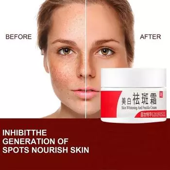 Крем против веснушек, увлажняющий, осветляющий кожу, удаляющий пятна, контролирующий жирность и укрепляющий кожу крем для лица 5G