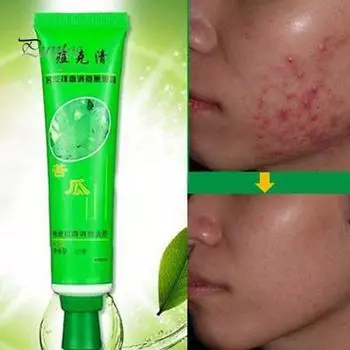 Крем Puntos для эффективного удаления прыщей, пятен, шрамов, растяжек, крем для ухода за кожей