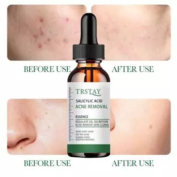 Крем с ретинолом для лица Лучший увлажняющий крем для лица для стареющей кожи с коллагеном и гиалуроновой кислотой – антивозрастной крем для лица