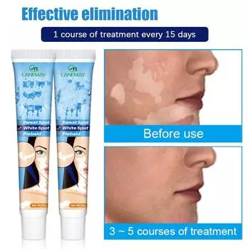 Кремы для лица Лосьоны Болезни Кремы и лосьоны для лица Кремы и лосьоны для лица Кремы и лосьоны для лица Болезни Крем от белых пятен 20г 1 Pcs