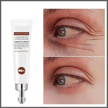 Крокодиловый антивозрастной крем для глаз с гиалуроновой кислотой, отбеливающий, увлажняющий, удаляет темные круги, отечность 20ml