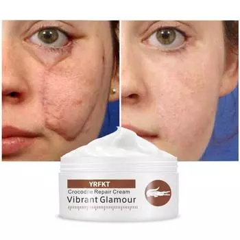 Крокодиловый крем для лечения шрамов и прыщей, уход за лицом, восстанавливающий крем, лечение растяжек, отбеливающий дневной крем 5G