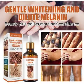 Куркума, масло лимона, сияние кожи, темные пятна, прыщи, яркая кожа, корректор темных пятен, отбеливающая сыворотка для лица