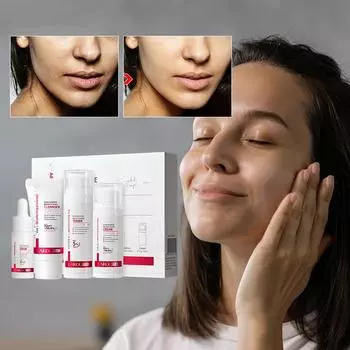 LAIKOU Pro Niacinamide Skincare Set Антивозрастной сывороточный крем Осветляющий тоник для умывания лица Niacinamide Set