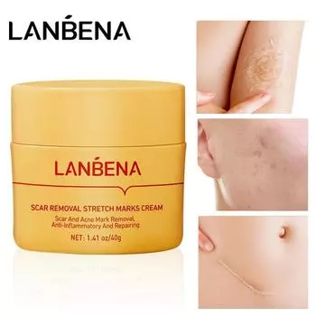 LANBENA крем для удаления шрамов, акне, растяжек, увлажняющий крем для ухода за кожей, 40 г