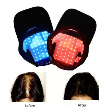 Лазерная терапия, шлем для роста волос, устройство против выпадения волос, колпачок для восстановления роста волос, 48 шт., лазер чёрный
