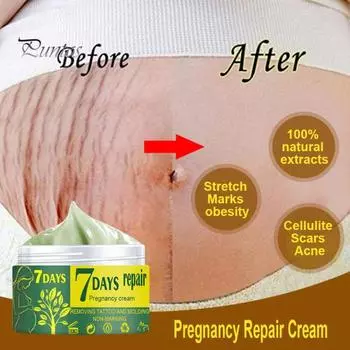 Легко впитывающийся крем для восстановления при беременности Puntos, крем для удаления растяжек, натуральные экстракты, крем для удаления шрамов на коже 50g