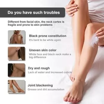 LGRAMER, отбеливающий крем для ухода за кожей для женщин, уменьшающий пигментацию, улучшающий потемнение ног, отбеливающий и восстанавливающий кожу