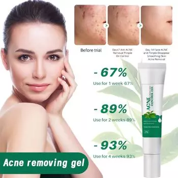 Лосьон для очищения кожи лица от прыщей и угрей One Size белый