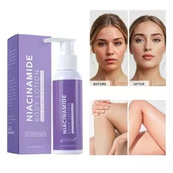 Лосьон для тела с ниацинамидом, отбеливающий и осветляющий, стойкий, делает кожу более сияющей 100 мл