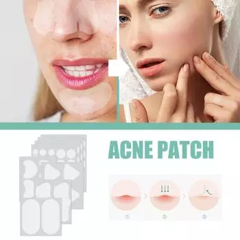 Маска-патч EELHOE Acne Mask Patch Мягкий и не раздражающий восстанавливающий пластырь для лица, устраняющий следы от угревой сыпи и прыщи 132pcs