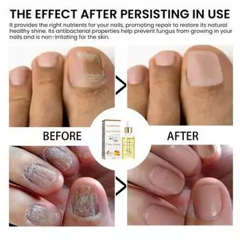 Масло для кутикулы Ремонт поврежденных ногтей Увлажнение кутикулы Натуральные ингредиенты Быстрые результаты жёлтый