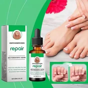 Масло для роста ногтей Leuconychia Масло для ногтей Mycosis Care For Nail Mycosis Foot Mycosis Red Brown Foot 30ML One size зелёный