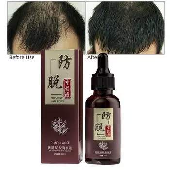 Масло для роста волос Dimollaure, улучшающее выпадение волос, рост волос, густая эссенция для ухода за волосами, 30 мл 1pc