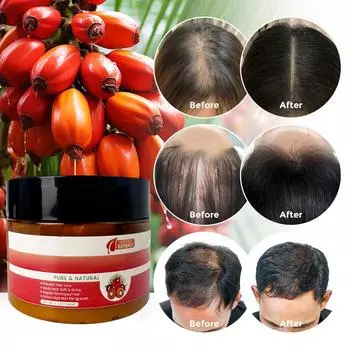 Масло Фуллера для роста волос, натуральное масло Фуллера для роста волос, предотвращает выпадение волос, улучшает питание волос