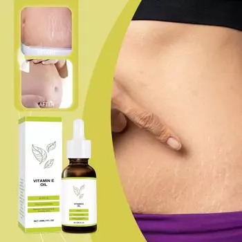 Масло от угревой сыпи, рубцов и растяжек Увлажняет кожу и повышает ее эластичность. Удаление шрамов от угревой сыпи и растяжек30 мл One size